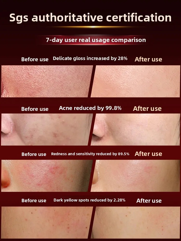 LED Photon Skin Rejuvenation Facial Mask with 7 Color Light Therapy